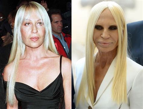 donatella versace jeune avant chirurgie|Donatella Versace plastic surgery.